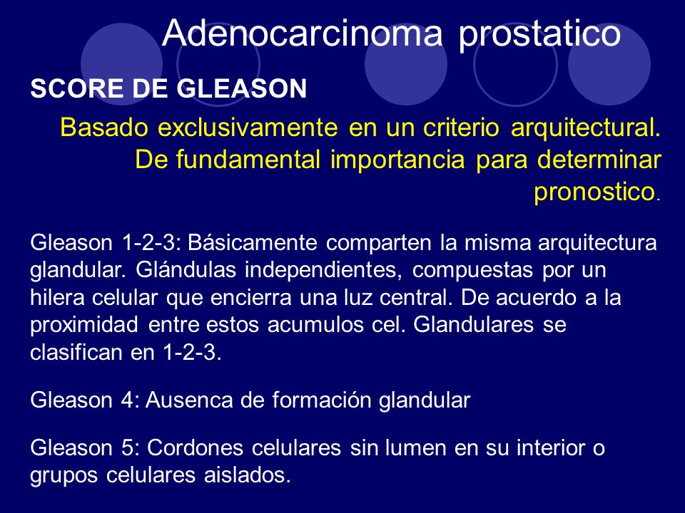 adenocarcinoma de próstata acinar tratamiento habitual de gleason 6
